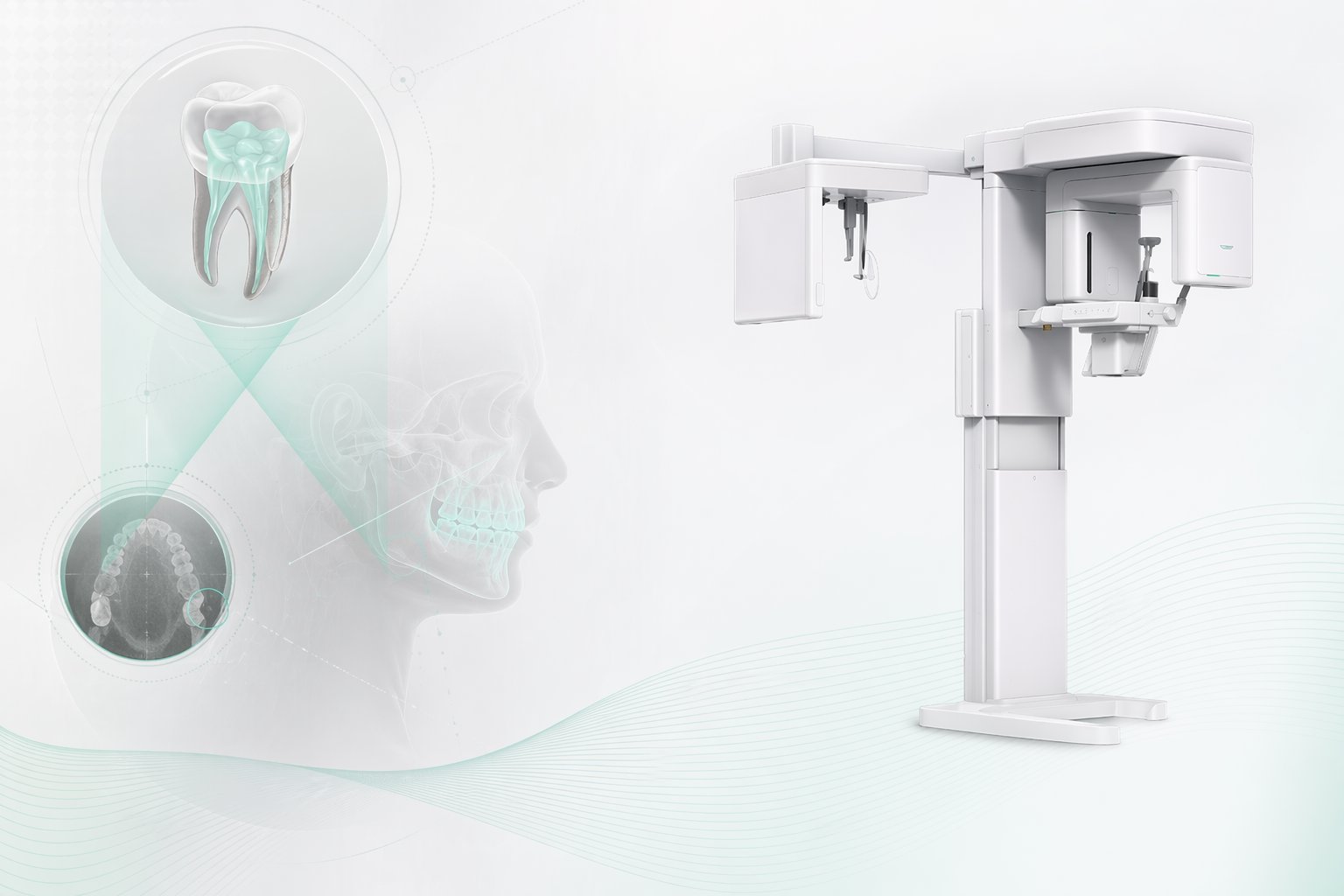 3D CBCT 임플란트 정밀 진단