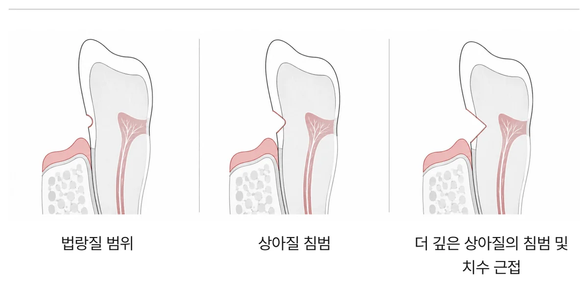 그림 5. 같은 자리가 깊어지는 세 단계