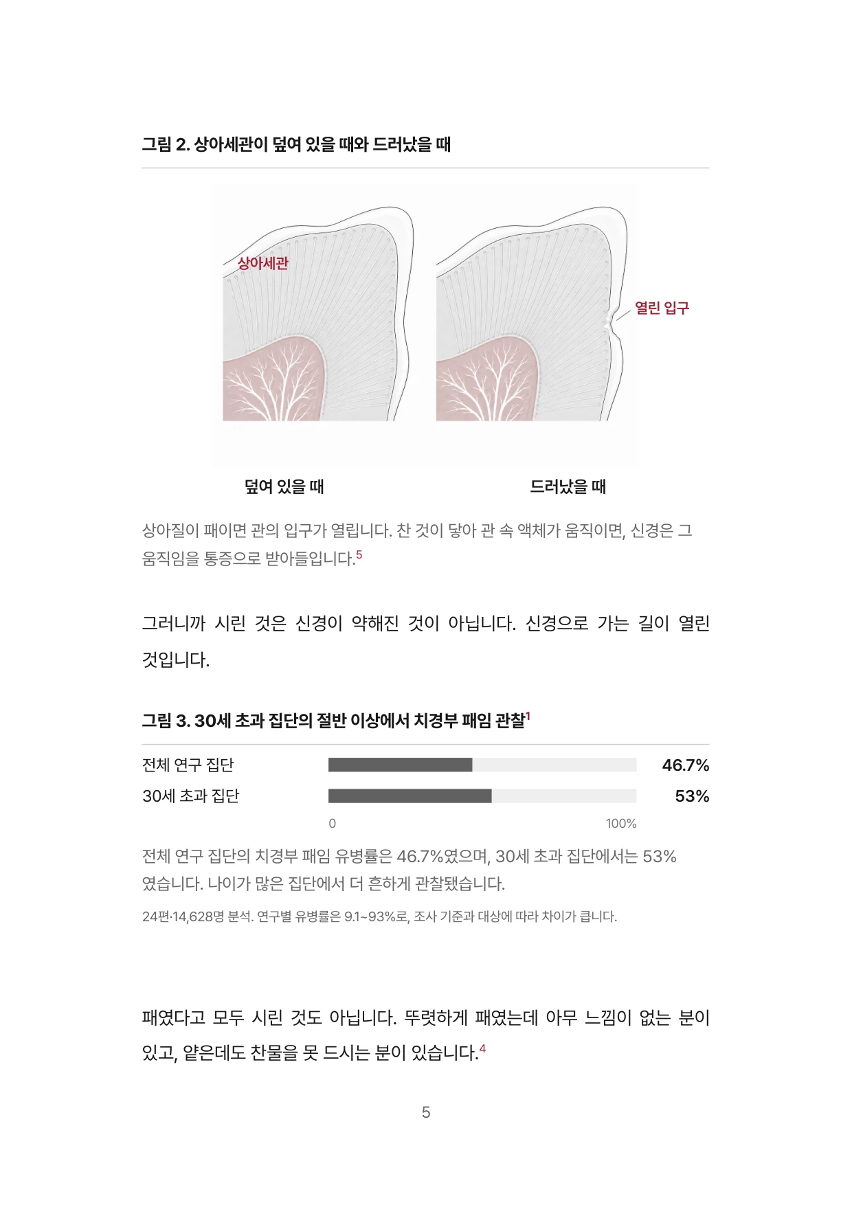 5면 상아세관이 드러났을 때와 치경부 패임 유병률