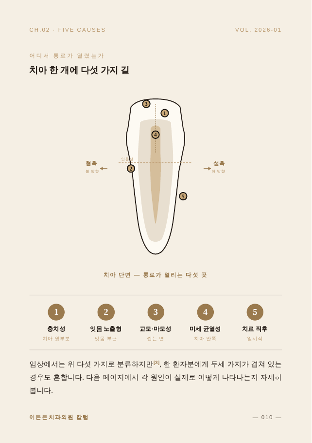 10면 치아 한 개의 다섯 가지 길