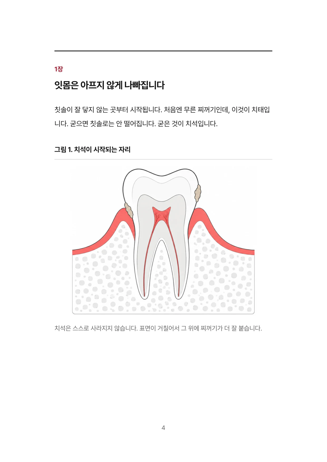 4면 1장 잇몸은 아프지 않게 나빠집니다
