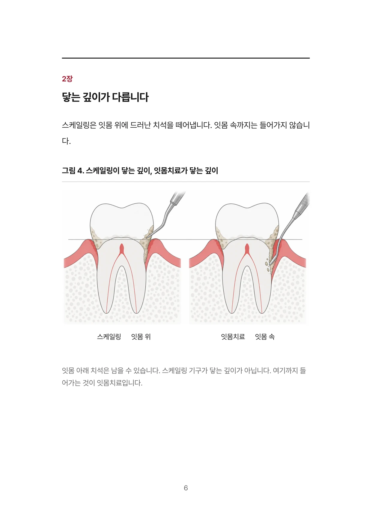 6면 2장 닿는 깊이가 다릅니다