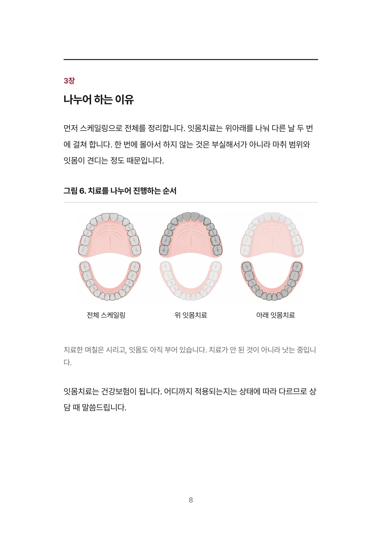 8면 3장 나누어 하는 이유