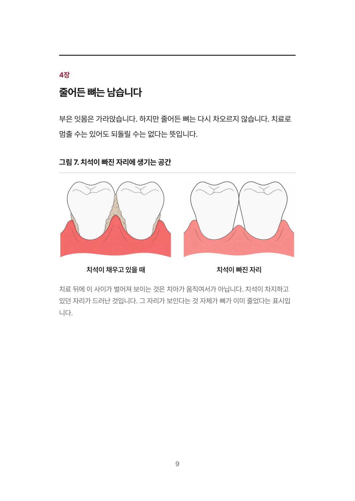 9면 4장 줄어든 뼈는 남습니다