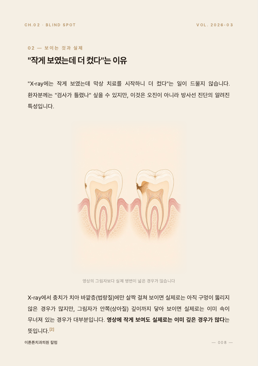 8면 작게 보였는데 더 컸다는 이유 인포그래픽