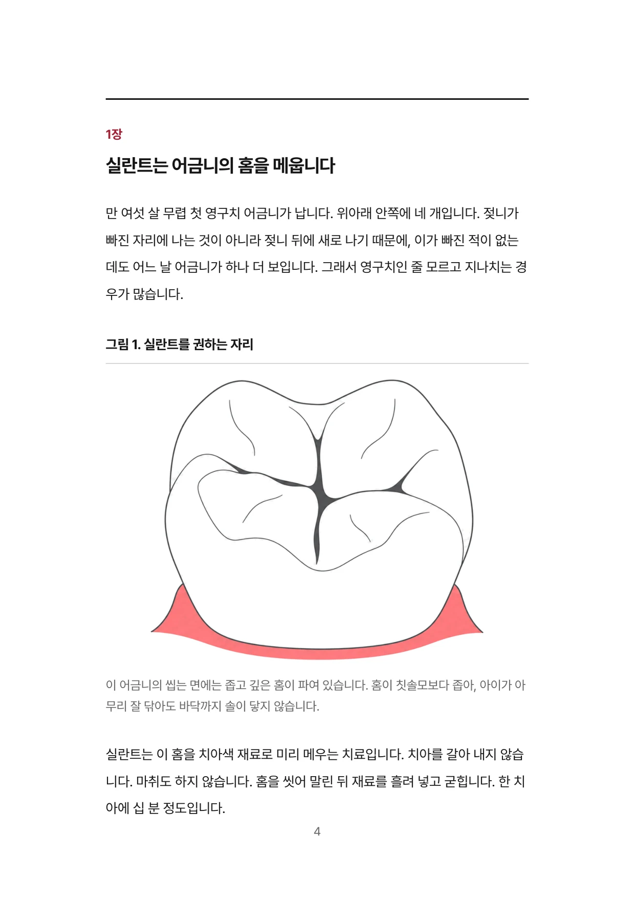 4면 1장 실란트는 어금니의 홈을 메웁니다, 실란트를 권하는 자리
