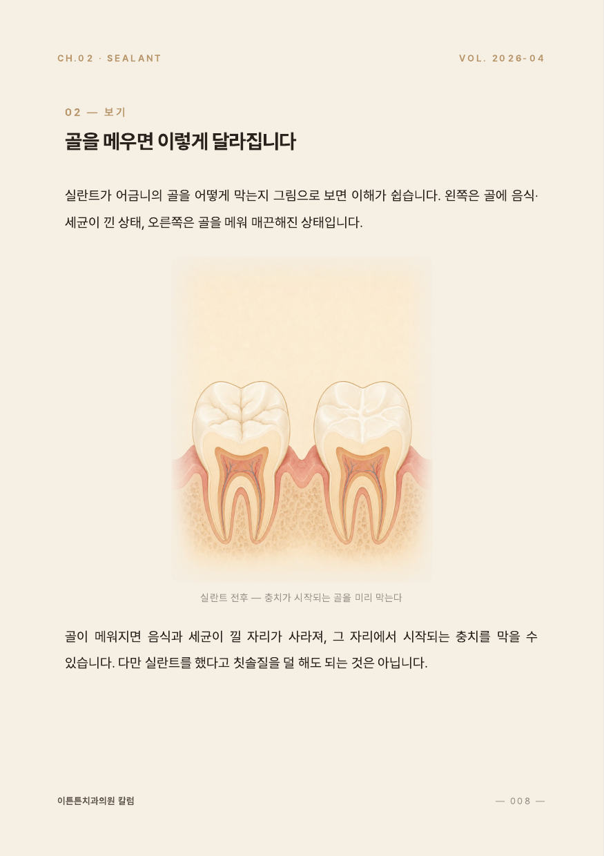 8면 골을 메우면 이렇게 달라진다 인포그래픽