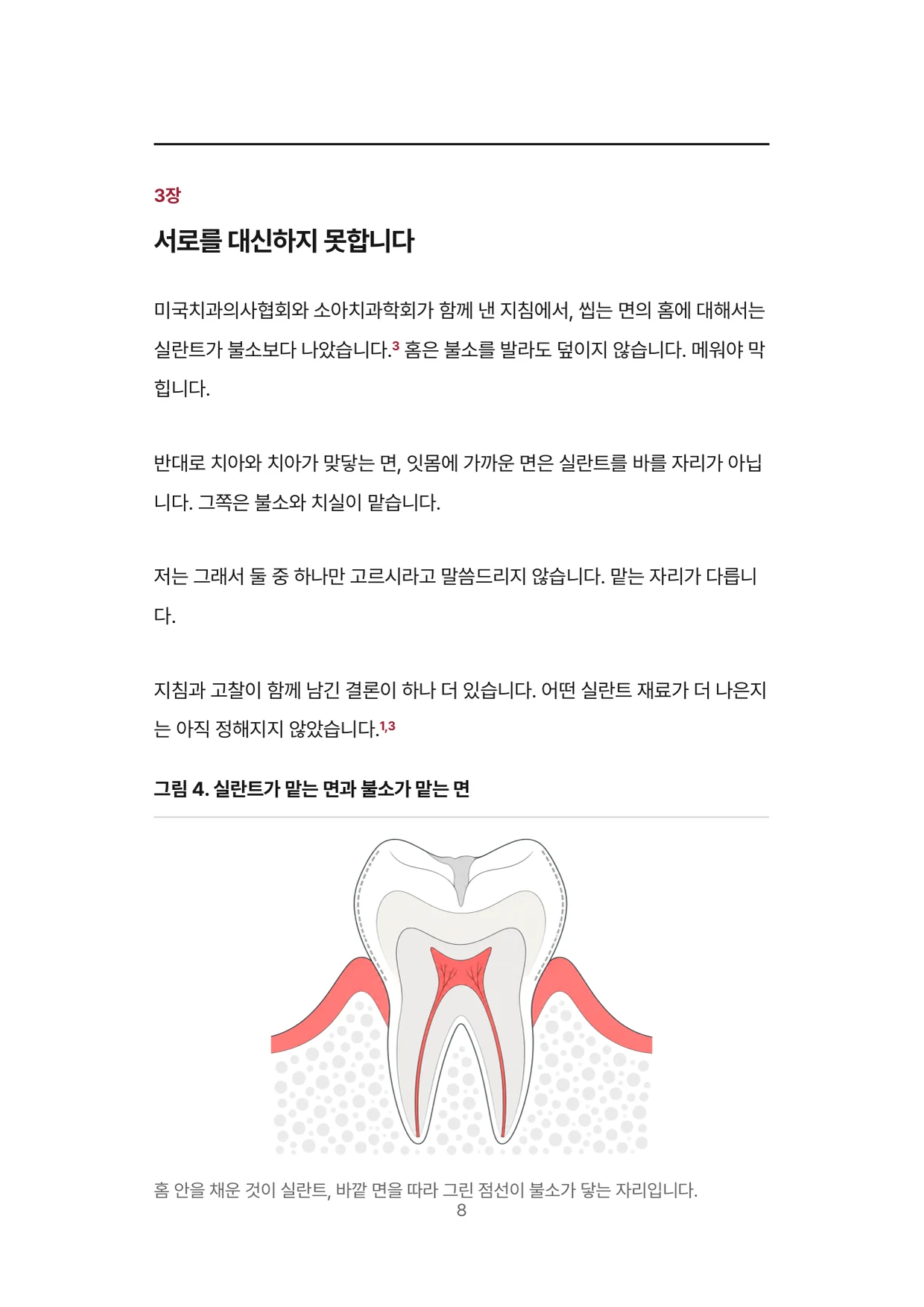 8면 3장 서로를 대신하지 못합니다, 실란트가 맡는 면과 불소가 맡는 면