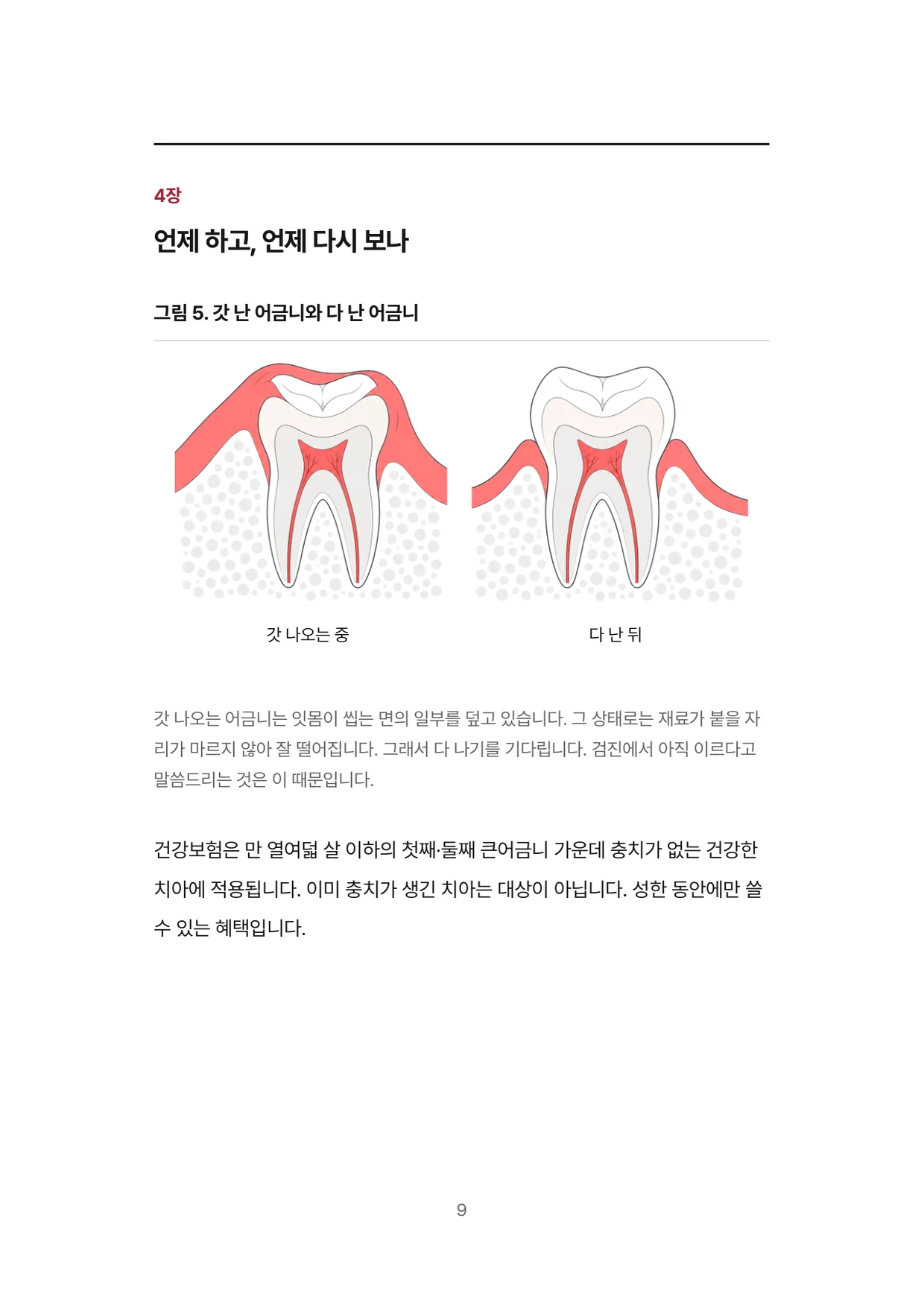 9면 4장 언제 하고 언제 다시 보나, 갓 난 어금니와 다 난 어금니