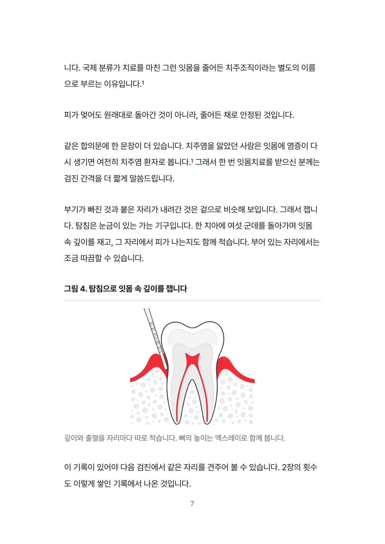 7면 탐침으로 잇몸 속 깊이를 잽니다